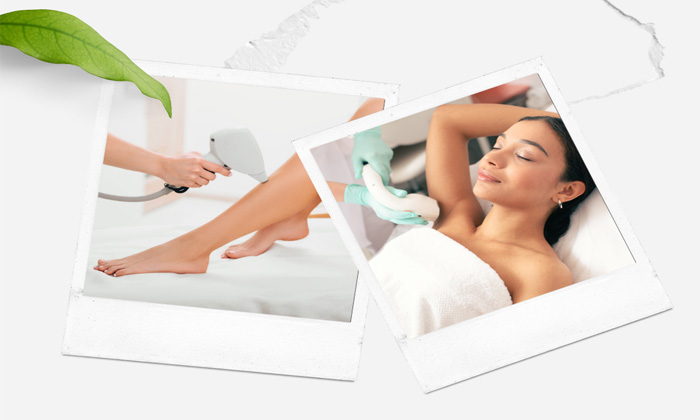 انواع دستگاه های لیزر موی زائد را بشناسید